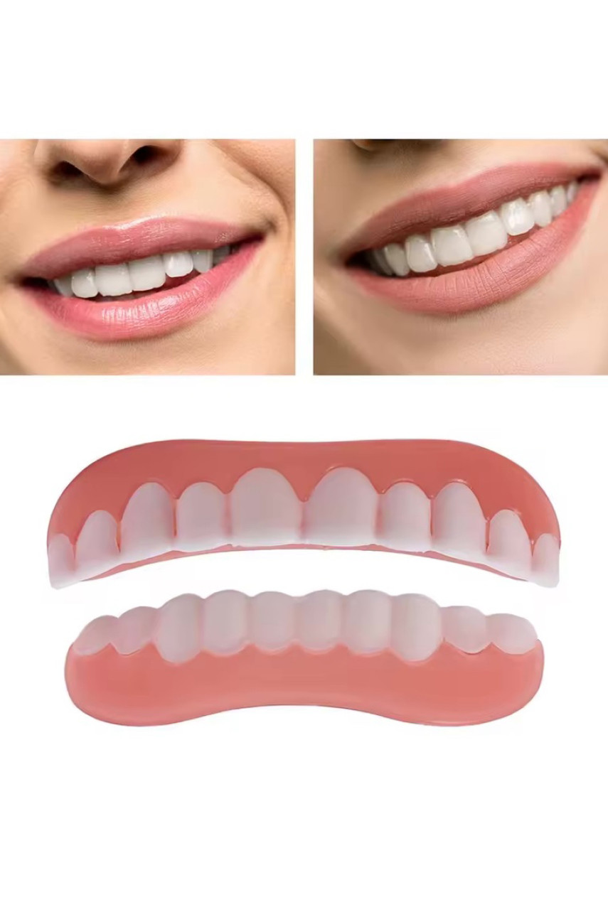 Вініри Perfect Smile для зубів 215733
